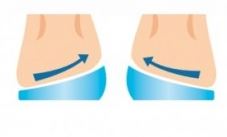 Pronation Heel Cups