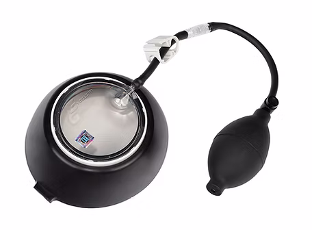 Vacuum Bell for Pectus Excavatum Vacuum Waist